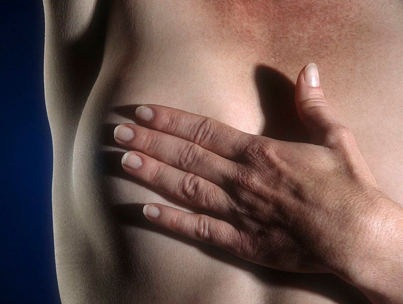 O câncer de mama é o segundo tumor mais incidente entre as mulheres, depois do câncer de pele.