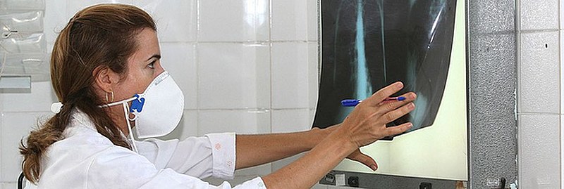 O Brasil é um dos países com maior incidência: uma média de 33,7 casos a cada 100 mil habitantes, sendo que o preconizado pela O