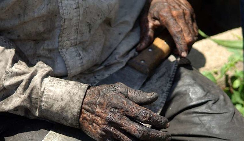 A Aspirina, um dos medicamentos mais vendidos na história, tem trabalho escravo em sua composição