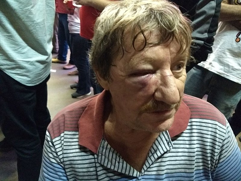 Padre Idalino Alflen levou uma pedrada na cabeça e foi atropelado por uma motocicleta quando chegava ao Sindicato dos Eletricitários