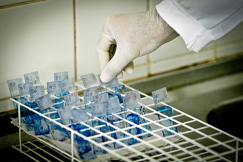 "A cada 18 segundos uma pessoa morre de tuberculose", diz relatório "Out of step", dos Médicos Sem-Fronteiras