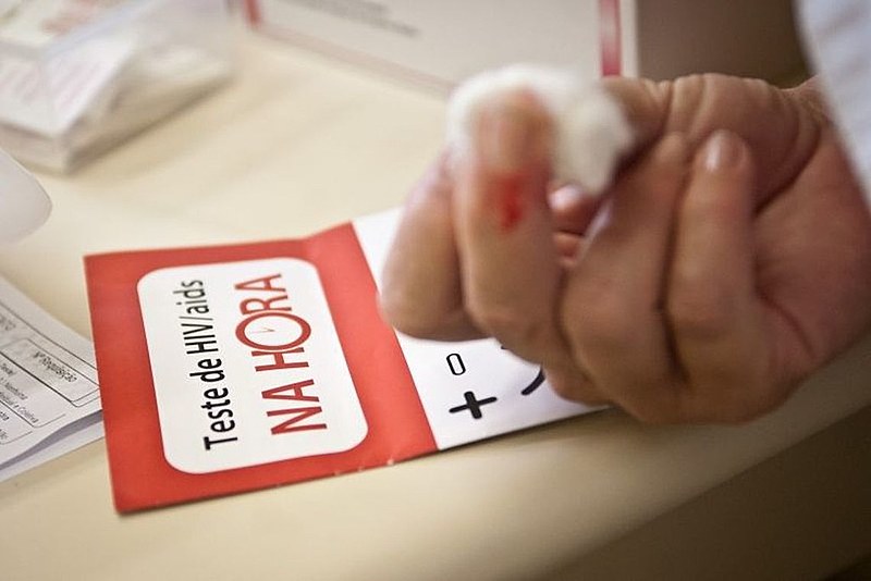 Em 2019 Bolsonaro excluiu o termo “AIDS” do departamento nacional que trata sobre DST’s