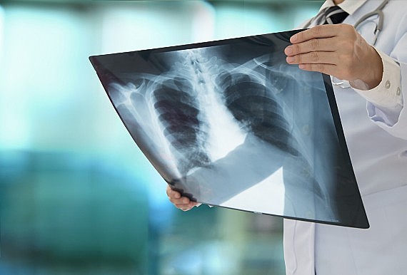Falta de saneamento básico, moradias precárias, dificuldades na prevenção e tratamento, podem agravar incidência de casos.