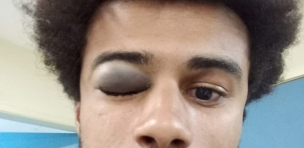 Após a agressão, o estudante desmaiou e foi levado para o Hospital Souza Aguiar, no centro do Rio