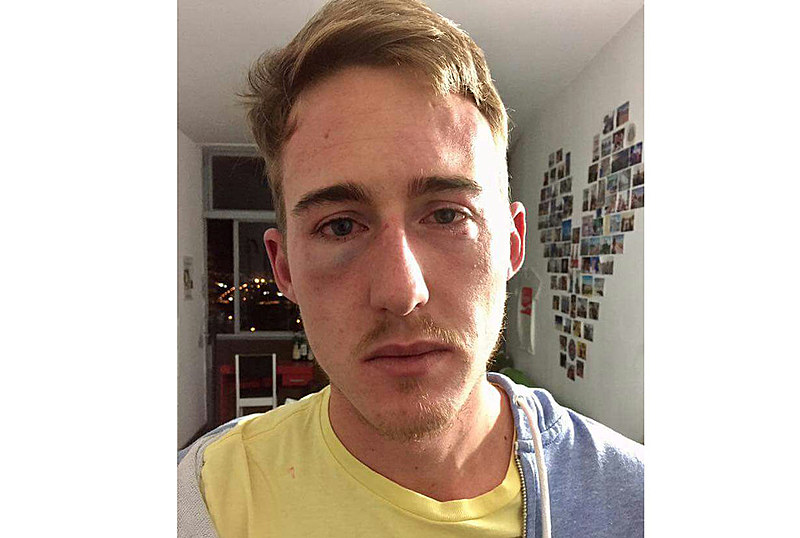 O norte-americano Shane Landry, que teve diversas escoriações pelo corpo, publicou desabafo em rede social