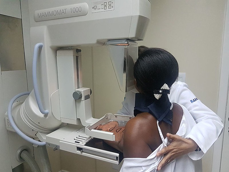 Unidade móvel do Hospital da Mulher no estado da Bahia realiza mamografias para mulheres a partir dos 40 anos