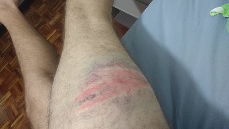 Denunciam agressão, abordagem truculenta, prisões e quebra de celulares