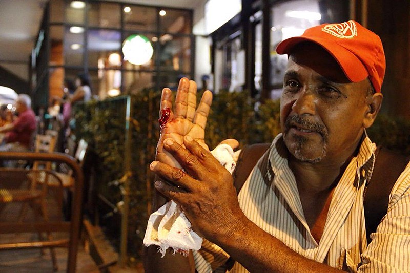 Militante do MTST é atingido por estilhaço de bomba em ato
