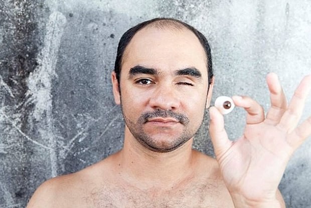 Sérgio Silva portava apenas a máquina fotográfica e registrava os protestos de 13 de junho de 2013 quando foi atingido no rosto por uma bala de borracha