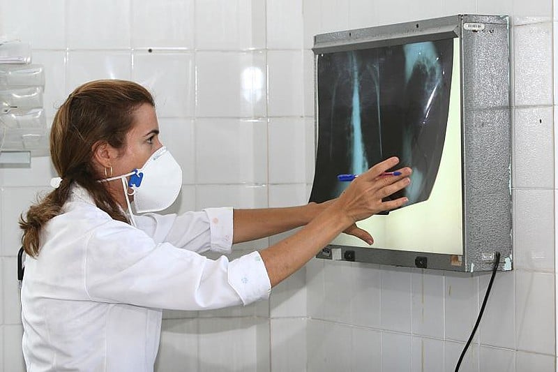 Estado do Rio de Janeiro possui a segunda maior incidência de casos de tuberculose no país