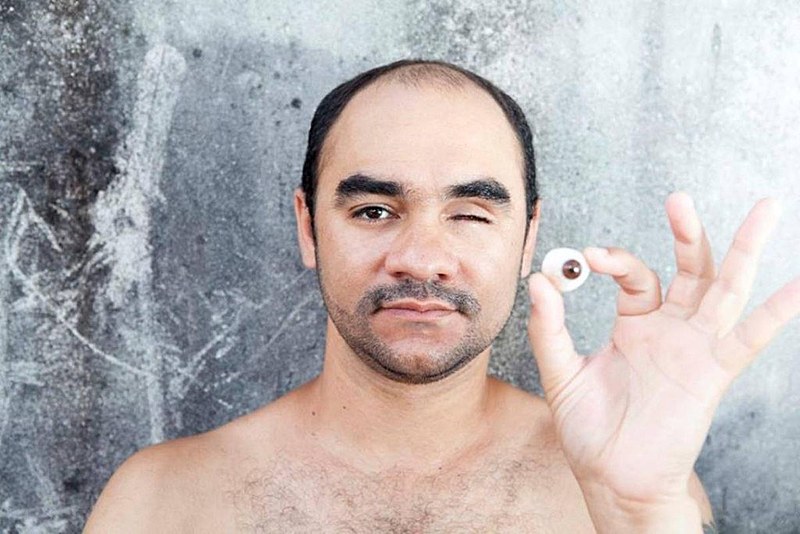Fotógrafo Sérgio Silva perdeu o olho esquerdo, seu instrumento de trabalho, em decorrência da ação da PM
