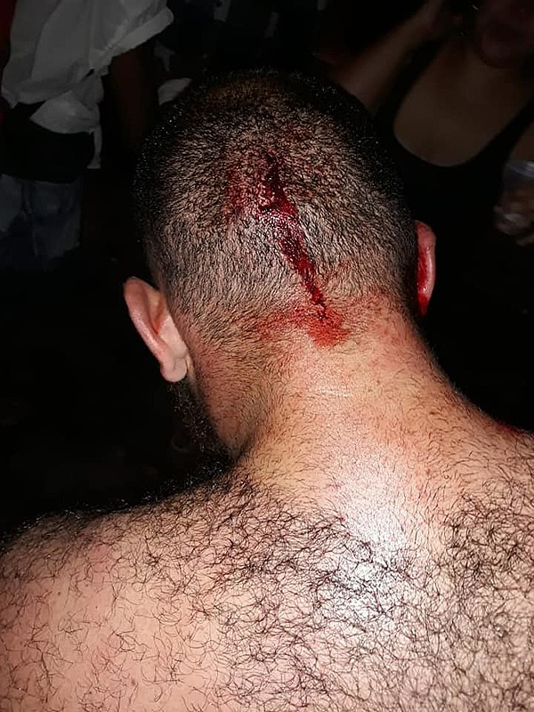 Estudante da Federal do Paraná agredido por eleitores do Bolsonaro em Curitiba
