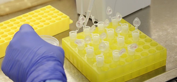 Vacina, teste, laboratório
