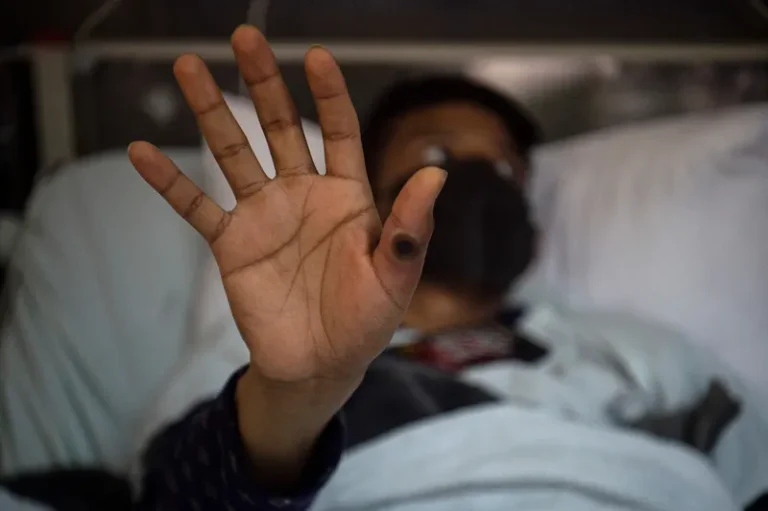 'Exige preocupação, mas longe de ser a mesma de uma pandemia', diz sanitarista sobre mpox