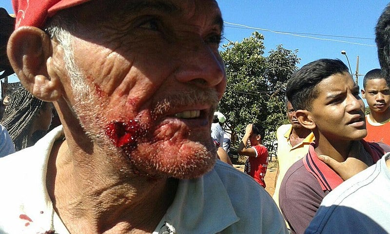 O ataque do Choque deixou diversos feridos, inclusive idosos, uma mulher grávida e uma criança de menos de dois anos