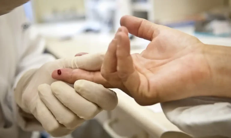 Epidemia da Aids, uma realidade latente há mais de quatro décadas