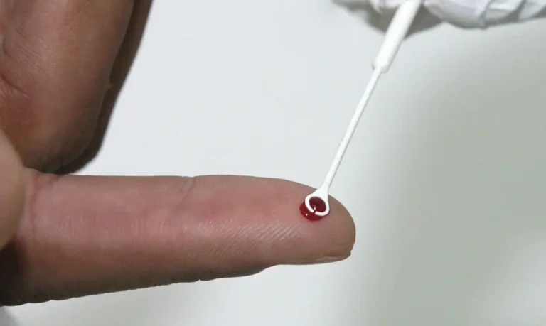 ‘Toda pessoa deve se testar’: infectologista alerta para desigualdades no combate ao HIV