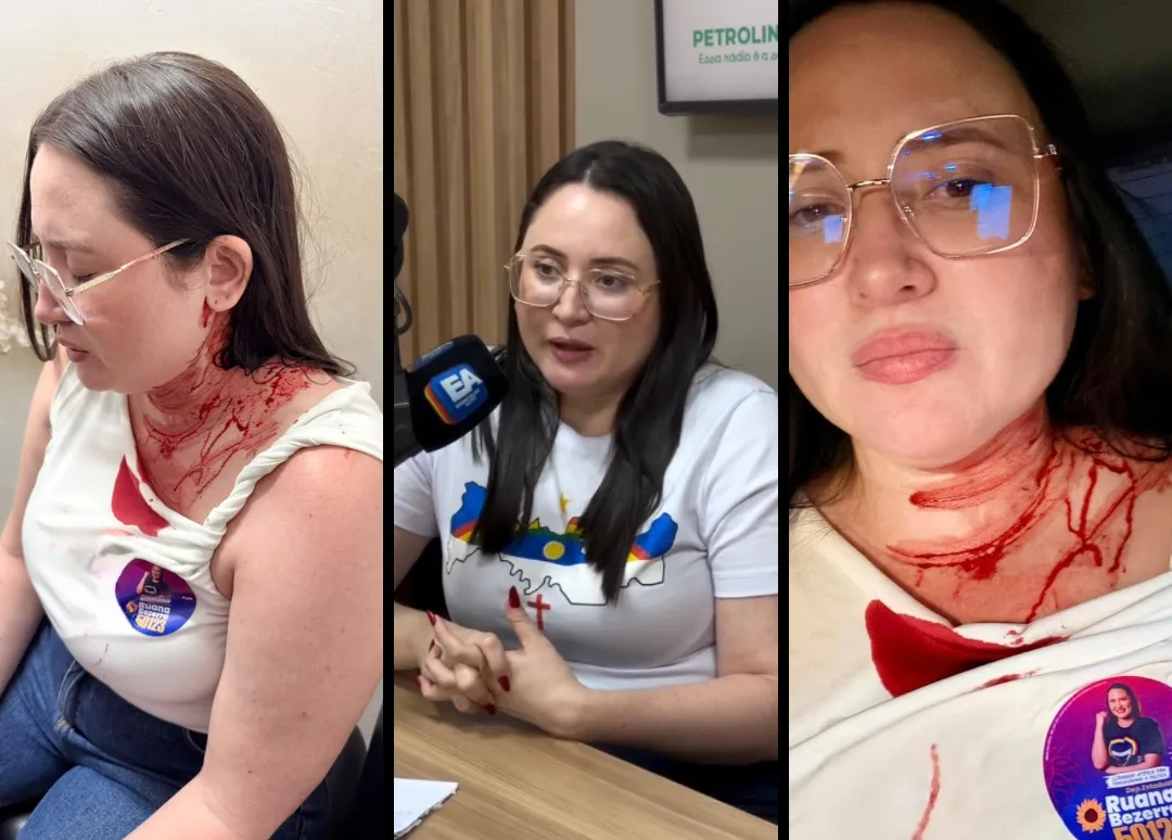 A advogada e candidata a deputada estadual Ruana Bezerra (Psol) foi atingida na cabeça por uma pedra, arremessada contra ela durante uma caminhada em Ouricuri (PE)